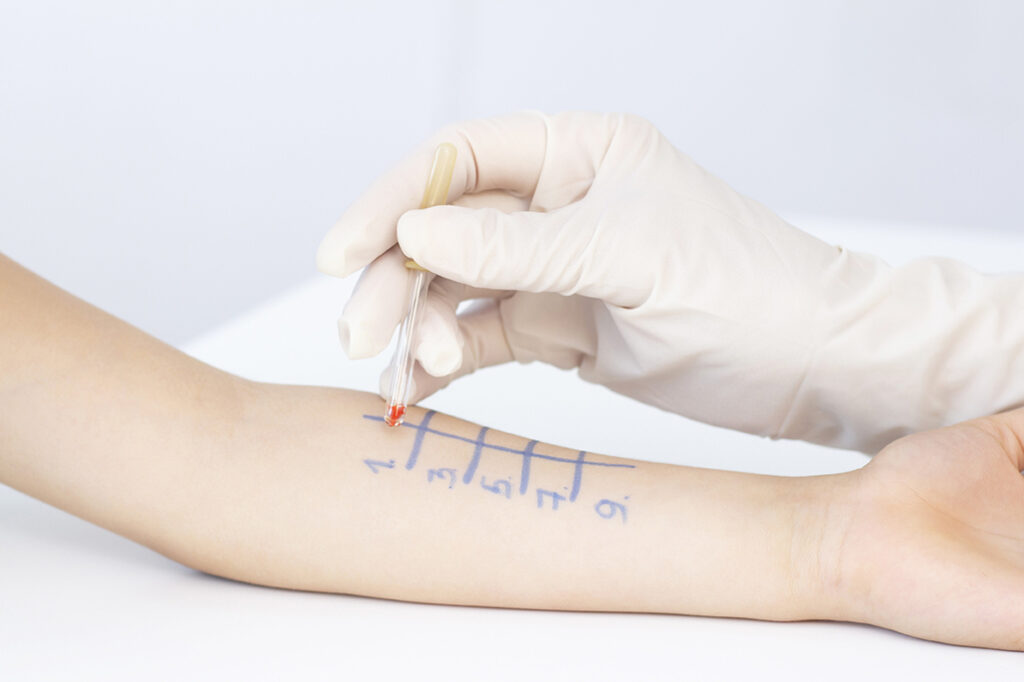 Alergologija ir klinikinė imunologija