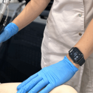 Plaukelių šalinimas Aleksandrito Deka Again Pro lazeriu