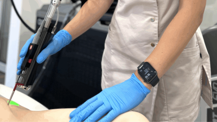 Plaukelių šalinimas Aleksandrito Deka Again Pro lazeriu