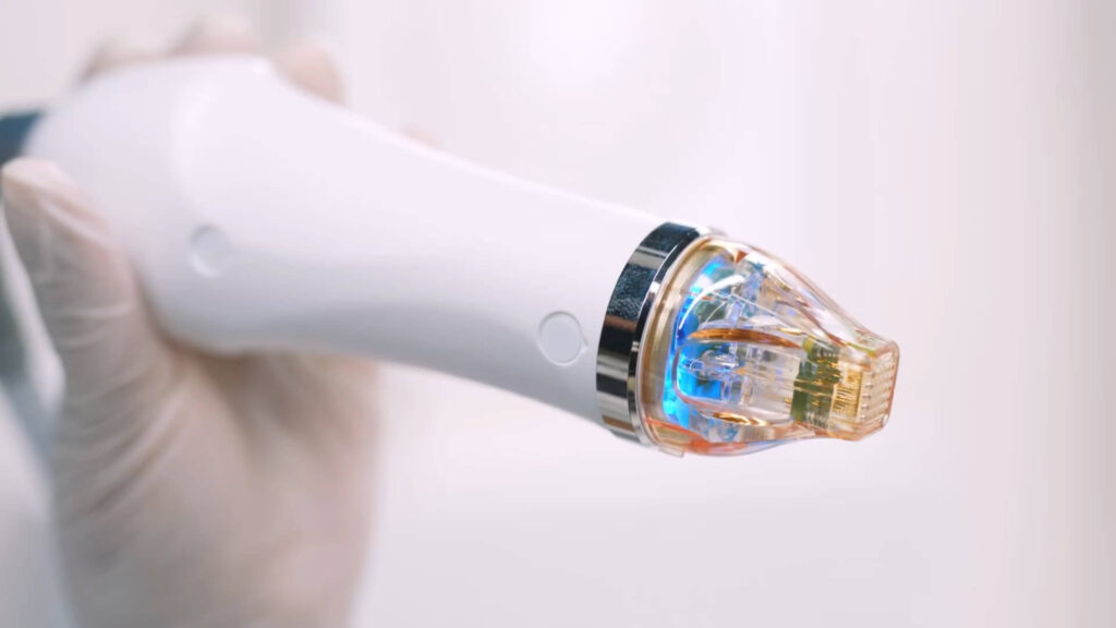 Secret RF mikroadatinis odos atjauninimas