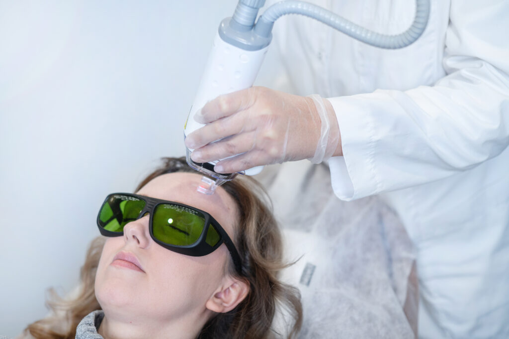 Aknės ir kitų randų gydymas lazeriu