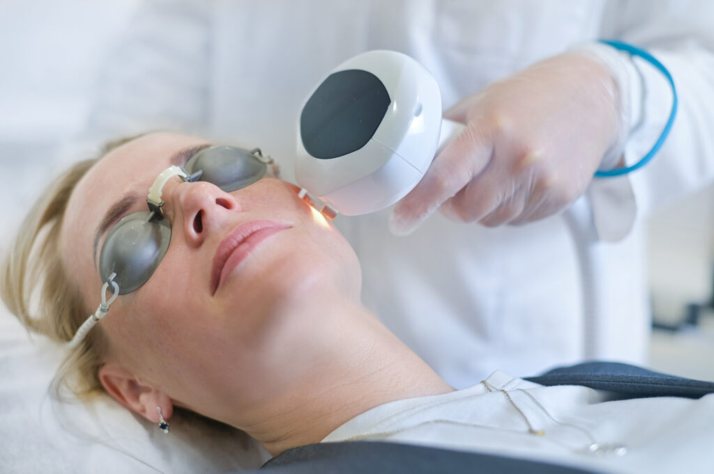 Difuzinio raudonio (rožinės), aknės, hiperpigmentacijos gydymas impulsine šviesa (IPL)
