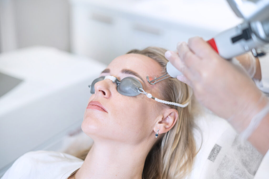 Pigmentacijos šalinimas lazeriu