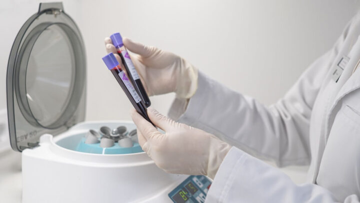 Kraujo plazmos procedūros (PRP plazmoliftingas, I-PRF)